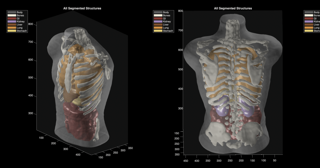 Midjourney Medical Launches Innovative Full-Body Ultrasound Scanner